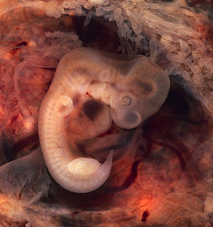 300px-Human_embryo_5_weeks.jpg