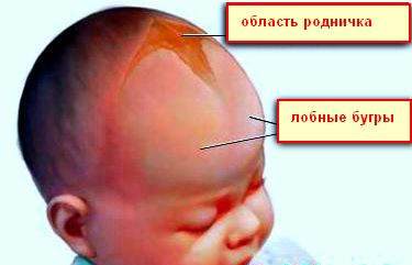rodnichok.jpg