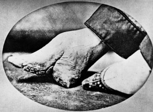 foot-binding1.jpg